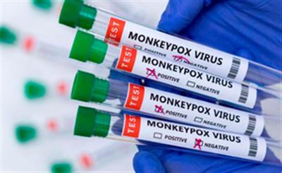 Mpox vax procurement in Africa key to contain outbreak: Report