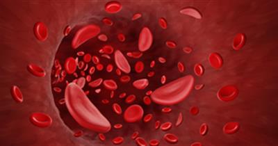 ICMR, Zydus tie up for clinical trial to combat sickle cell disease