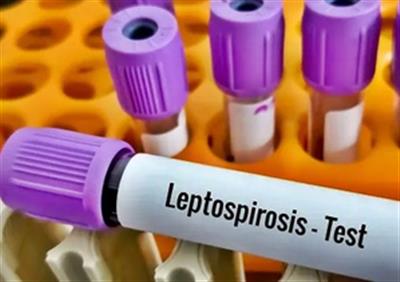 Leptospirosis cases continue to rise in the Philippines