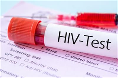 Global diagnosed HIV prevalence to reach over 2.2 mn in 2033: Report