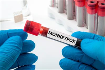 दक्षिण अफ्रीका में monkeypox के तीन नए मामले सामने आए