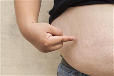 Over half of adults, third of children to become overweight or obese globally by 2050: Lancet